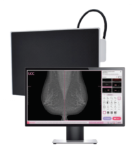 Vieworks - Innovative Digital Mammography Upgrade Solution