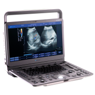Ultrasound System DUS - 5000 +