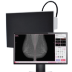 Vieworks – Innovative Digital Mammography Upgrade Solution