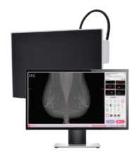Vieworks – Innovative Digital Mammography Upgrade Solution