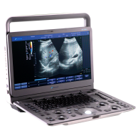 Ultrasound System DUS – 5000 +