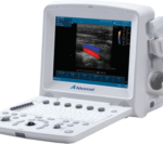 Ultrasound System DUS 5000